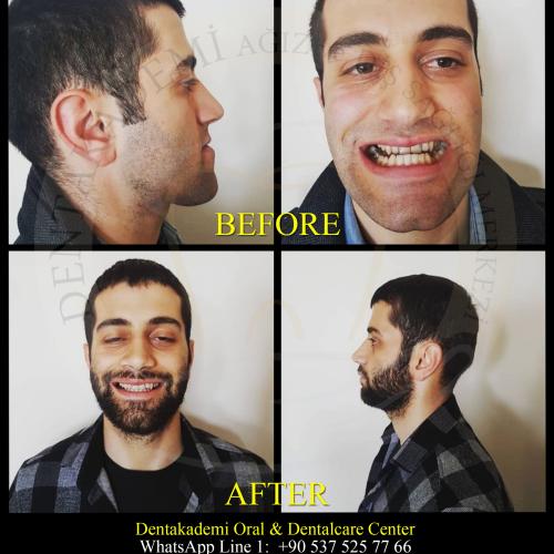 صور قبل وبعد لمرضانا 0